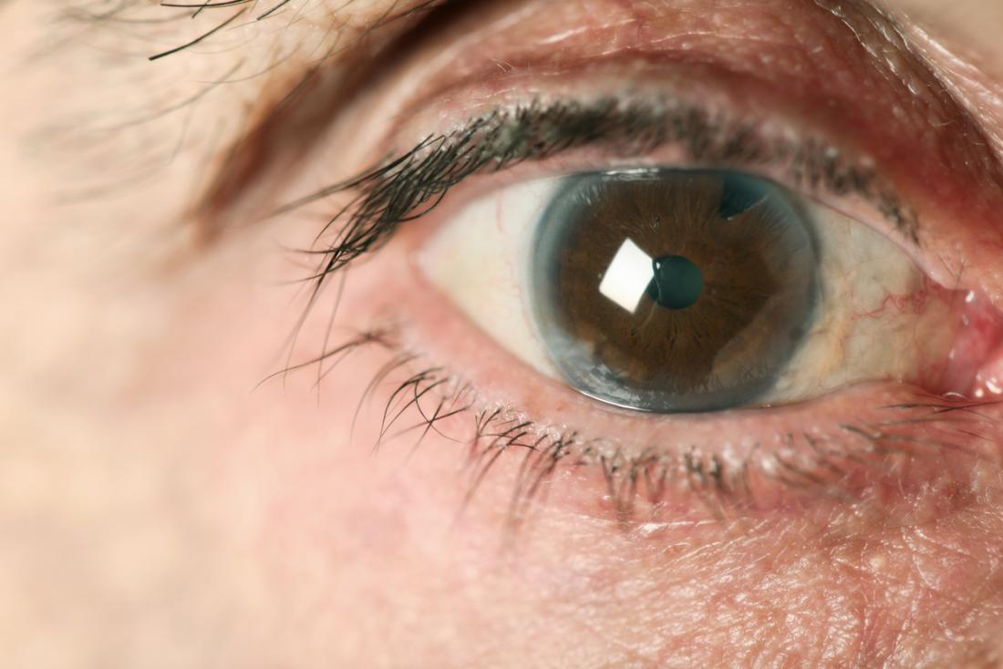 Iranian scientist discovers natural protein may help to prevent blindness