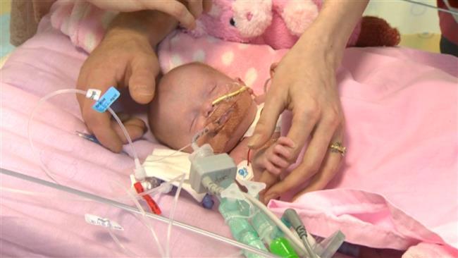 Baby born with heart outside her body survives surgery in UK first