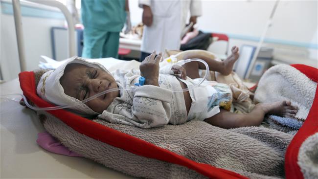 Iran warns of serious famine, starvation in Yemen