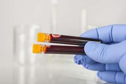 New DNA-based test to verify blood compatibility approved by FDA