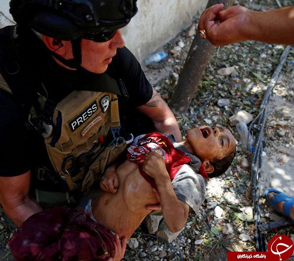 تصویری تکان دهنده از کودکی نجات یافته از دست داعش