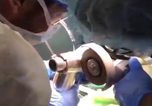 لحظه خارج کردن دست کودک دو ساله از چرخ گوشت+فیلم لحظه خارج کردن دست کودک دو ساله از چرخ گوشت+فیلم