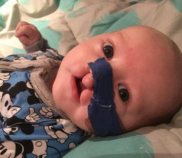 اولین لبخند نوزاد مبتلا به شدید ترین نوع شکاف کام و دهان+تصاویر
