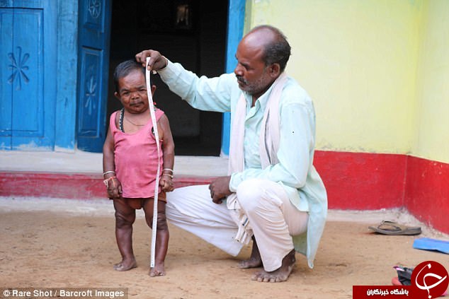 مرد هندی50 ساله؛ کوه غرور 29 اینچی 