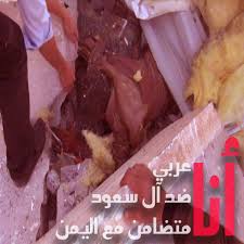 بالصور...العدوان السعودي على اليمن!