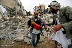 کودک یمنی؛ قربانی جنگ