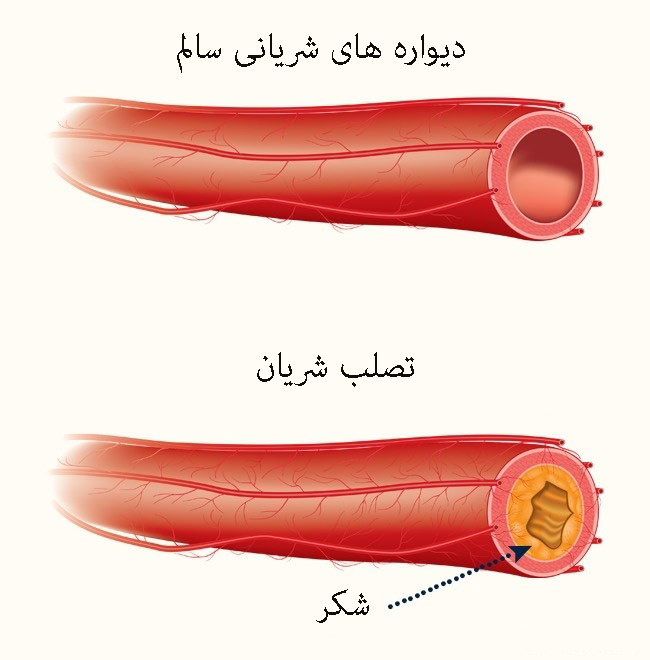 خطرناک ترین خواص شکر+تصاویر