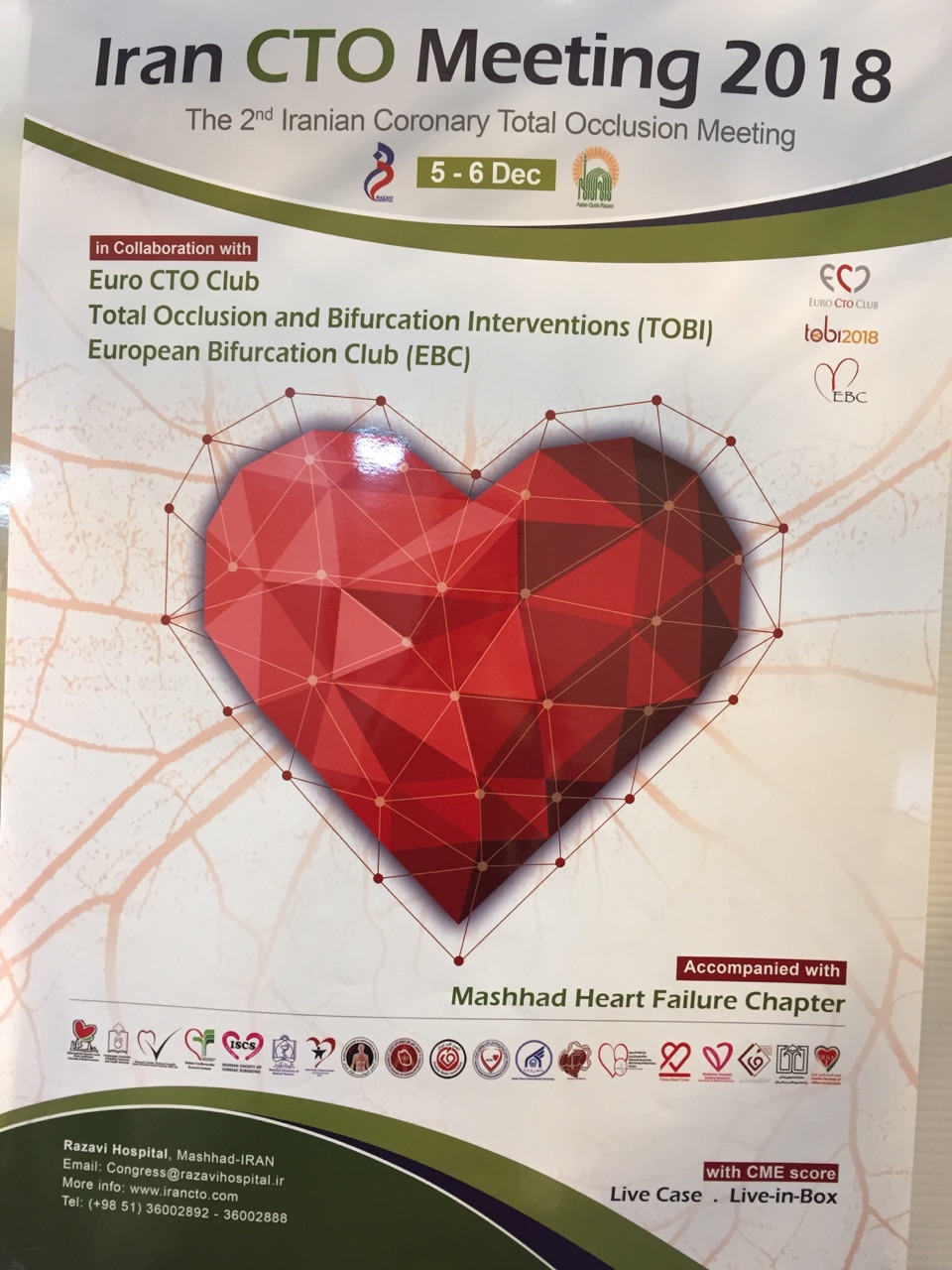 عمل زنده قلب جنین مبتلا به بیماری قلبی مادزادی در روز پایانی کنگره قلب ایران و اروپا