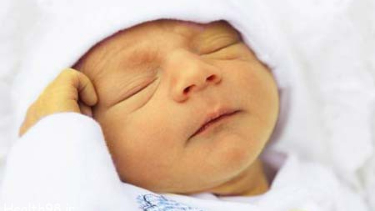 از عرق کاسنی تا حجامت؛ نسخه‌های خطرناک برای زردی نوزاد + فیلم